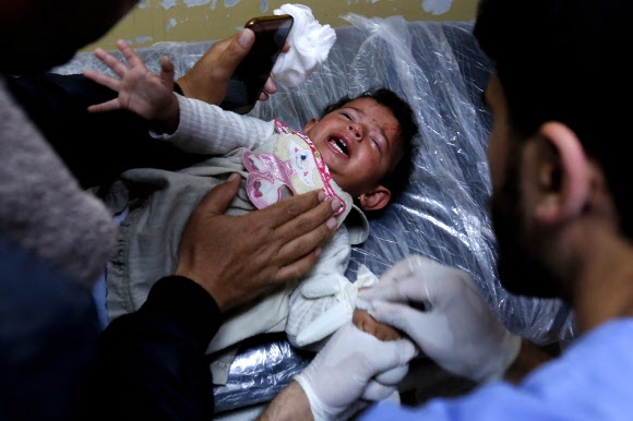 이스라엘군 공습에 다친 가자지구 어린이