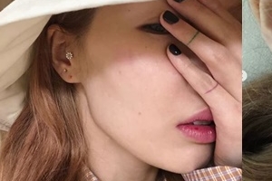 현아 “모두 정상이래요, 걱정마요” 공연 중 무슨 일이?