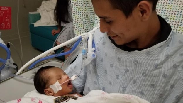 지난달 14일 아빠 요바니 로페즈가 엄마 자궁 안에서 끄집어내진 뒤 한달 만에 눈을 뜬 아들 야디엘을 품에 안고 바라보고 있다.
