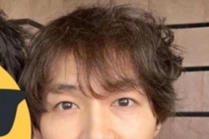 송중기 탈모사진, 화제 되는 이유는?