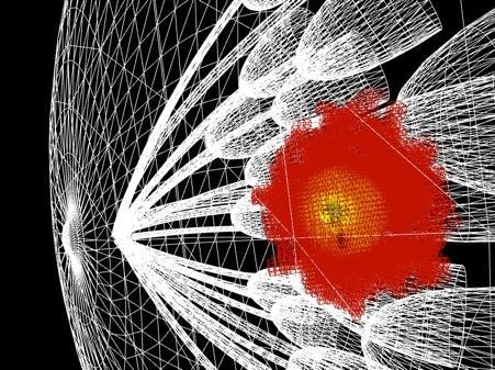 천문학자들이 별과 행성을 찾는 방법을 활용해 사람의 유방에 침투한 미세한 암조직(노란색과 빨간색 표시)까지 조기 발견하는 방법을 개발했다. 영국 엑서터대 제공