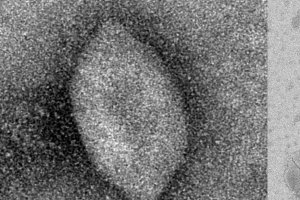 지구온난화 일으키는 해양 고세균 감염시키는 바이러스 찾았다