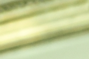 박윤국 포천시장 “국립수목원 지키기 위해 투쟁할 것”