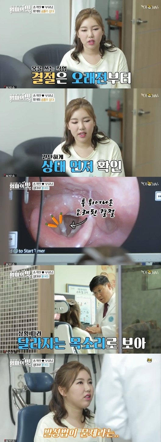 송가인 성대결절