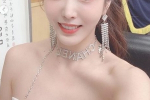 회사 권유로 견적도 모르고 전신성형한 여가수