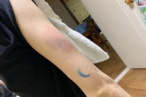 BJ찬, 여자친구 팔뚝에 시퍼런 멍 ‘결국 체포’ [종합]