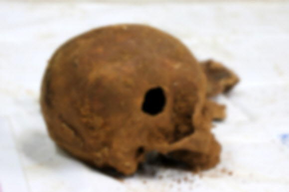 법무부는 옛 광주교도소 무연고자 묘지에서 40여구의 신원을 알 수 없는 유골이 발견돼 5·18민주화운동 행방불명자와의 연관성을 파악하고 있다고 22일 밝혔다. 사진은 발견된 유골 가운데 구멍이 난 두개골 모습. 5·18기념재단 제공