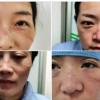 “성인용 기저귀까지 착용” 중국 의료진의 사투