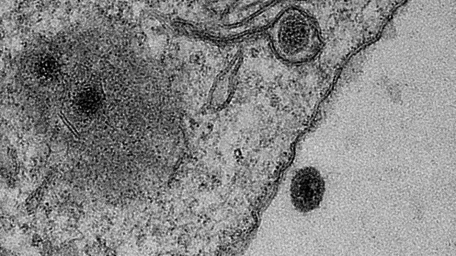 브라질 인공호수에서 발견된 정체불명 바이러스