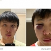 영국서 무차별 인종차별 폭행 “아시아인은 코로나 바이러스”