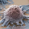 암세포 증식, 성장 유발하는 못된 단백질 찾았다
