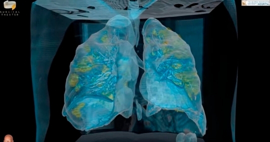 코로나19 확진자의 폐 모습을 VR로 구현한 영상. 