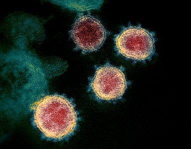 코로나 바이러스를 현미경으로 관찰한 모습 미국 국립보건원(NIH) 제공