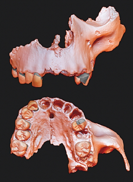 마이크로 컴퓨터단층촬영(micro-CT) 기술로 복원한 호모 안테세소르의 턱과 치아의 구조. 이를 통해 호모 안테세소르가 현생인류와 똑같은 얼굴 구조를 갖고 있다는 것을 확인했다. 스페인 국립인간진화연구소(CENIEH) 제공