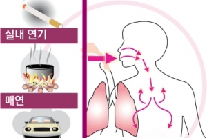 ‘콜록콜록’ 안 멎나요? 집콕 대신 걷고 뛰고, 털 달린 동물 멀리하세요