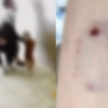 불도그 2마리, 푸들 안은 여성 허벅지 물고 안 놔…