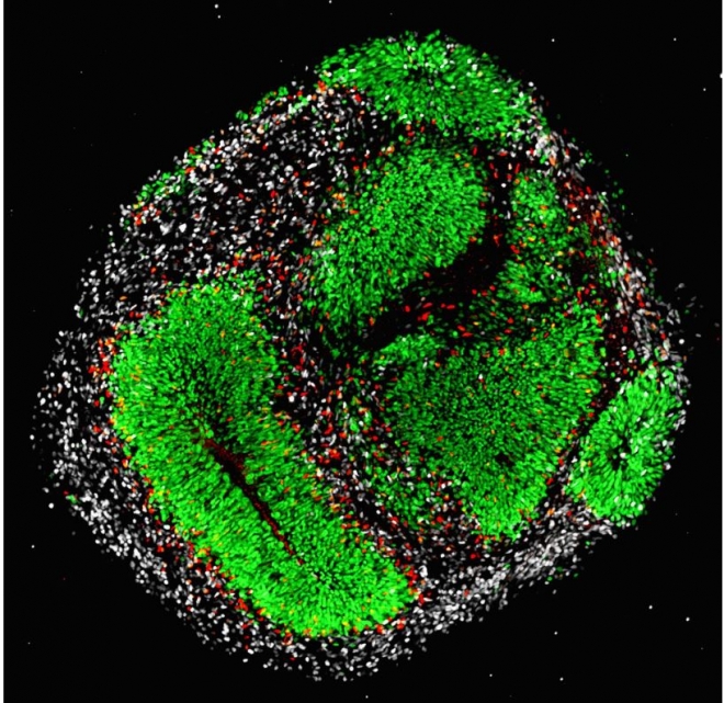 인간의 배아줄기세포를 배양한 뇌 오르가노이드. 녹색 부분은 줄기 세포, 빨간색은간(幹)세포,흰색은 신경 세포이다. 취리히대학 제공