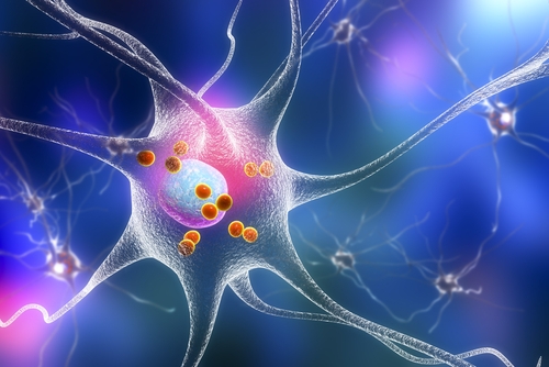파킨슨, 알츠하이머 일으키는 세포소기관 소통조절 단백질 발견