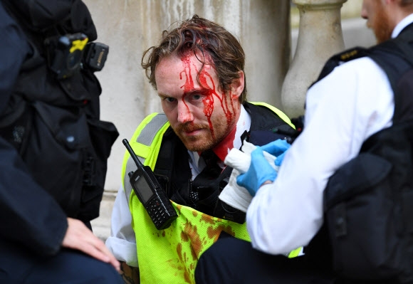 7일(현지시간) 영국 런던에서 미국 백인 경찰의 과잉 진압으로 흑인 조지 플로이드가 사망한 사건에 항의하는 시위대와 충돌한 한 경찰관이 부상을 당해 피를 흘리고 있다. 로이터 연합뉴스