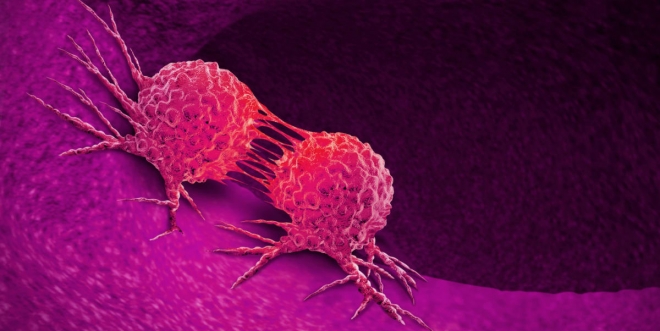 암 예방과 치료 가능한 나노항암백신 개발