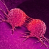 암 예방과 치료 가능한 항암나노백신 나왔다