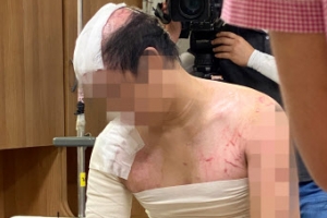 [포토] ‘처참한 모습’ 중학교 후배 가혹행위 피해자