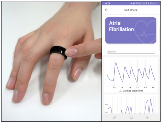 반지형 심장 모니터링 의료기기 카트-원을 통해 맥박을 측정하는 모습. 스카이랩스 제공