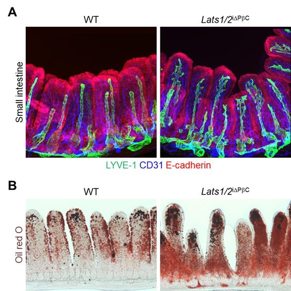 소장 기질세포 내 얍/태즈 단백질 과활성에 따른 암죽관의 형태와 기능 변화