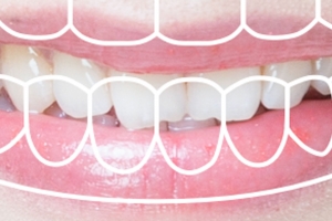 성남시 초등 5학년생 ‘치과주치의’ 온라인 서비스