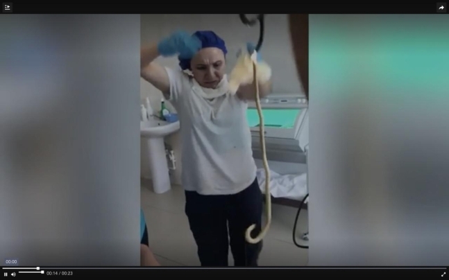 여성의 몸에서 꺼내든 뱀을 보고 놀라는 의료진/러시아 방송 채널5 동영상