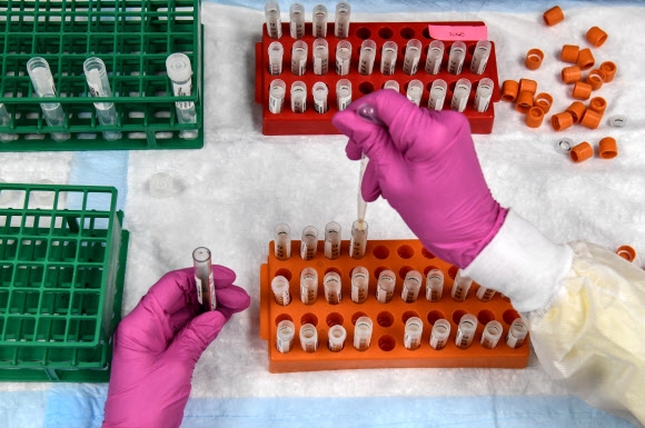 지난달 13일(현지시간) 미국 플로리다주 할리우드에 있는 미국연구센터에서 코로나19 백신 개발 중인 연구원이 혈액 샘플을 정리하고 있다. AFP 자료사진 연합뉴스