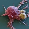 [사이언스 브런치] 암세포만 죽이고 부작용은 줄이고 면역기능은 높이는 암치료제 나왔다