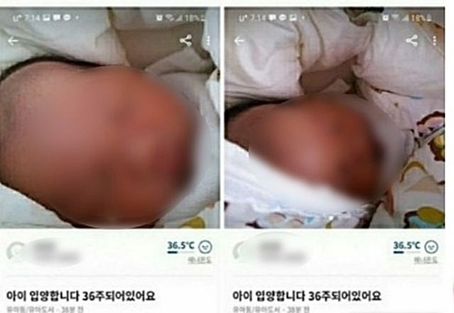 36주 아이 20만원