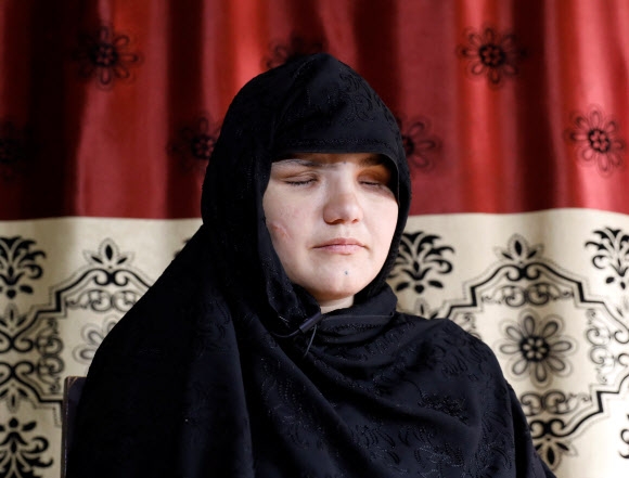 취직했다는 이유로 테러당해 실명한 아프간 여성 경찰 직업을 가졌다는 이유로 아버지의 사주를 받은 탈레반 괴한들로부터 두 눈을 공격받아 실명하게 된 아프가니스탄 여성 카테라(33). 카테라는 경찰이 된 지 3개월 만에 끔찍한 범죄 피해를 입고 현재 치료를 받고 있다. 사진은 지난 10월 12일 수도 카불에서 인터뷰하는 모습. 2020.11.11  로이터 연합뉴스