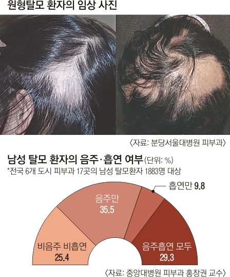 건조한 날씨 머리카락이 '듬성듬성'… 모발에 영양분 주세요 | 서울신문