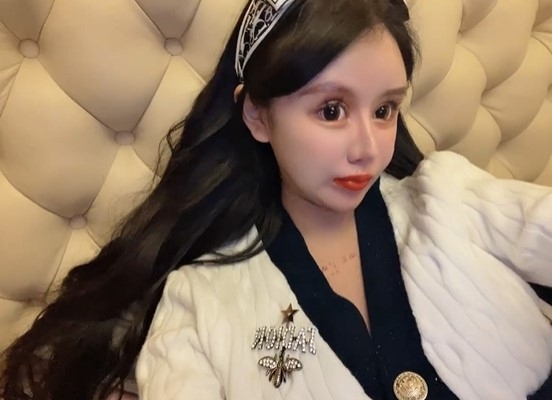 저우추나는 13세부터 성형을 받기 시작해 16세까지 100차례 이상의 성형수술을 받았다. 웨이보