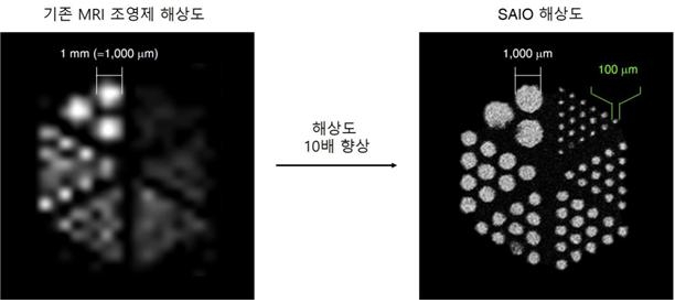 ‘사이오’를 이용해 찍은 MRI 영상