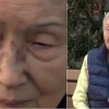 83세 뉴욕 교민 할머니 “주먹 날리고 침 뱉은 그 남자 용서해야지”
