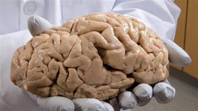 1.4㎏의 ‘뇌’는 인간을 인간답게 만드는 가장 중요한 신체기관이지만 여전히 완전히 파악되지 않은 미지의 세계이다. 미국 하버드의대 맥린병원 제공