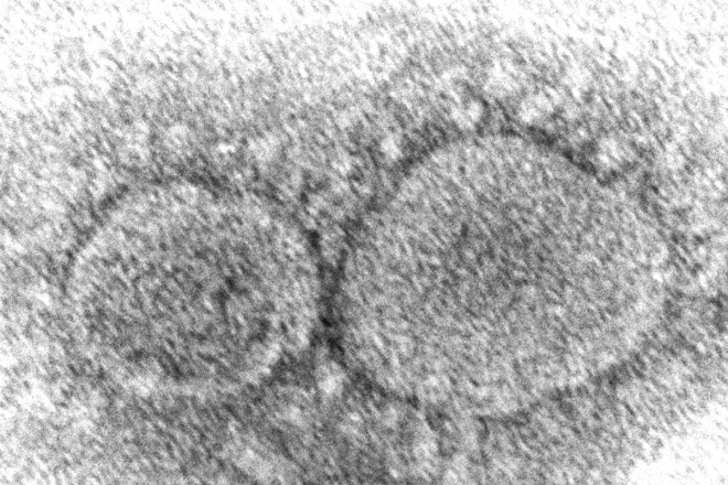 미국 질병통제예방센터(CDC)가 전자현미경으로 촬영한 코로나19 바이러스.  CDC 제공 