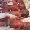 ‘세계 최초’ 아프리카 여성, 아홉 쌍둥이 출산