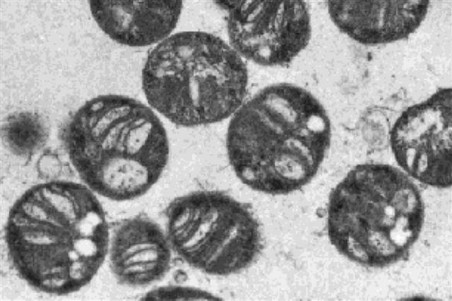 독성화학물질을 감지할 수 있는 센서에 활용된 미생물 메틸로트로프의 모습. 위키피디아 제공
