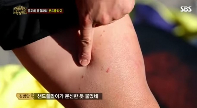 공포의 흡혈곤충 샌드플라이. SBS 정글의 법칙 영상 캡처
