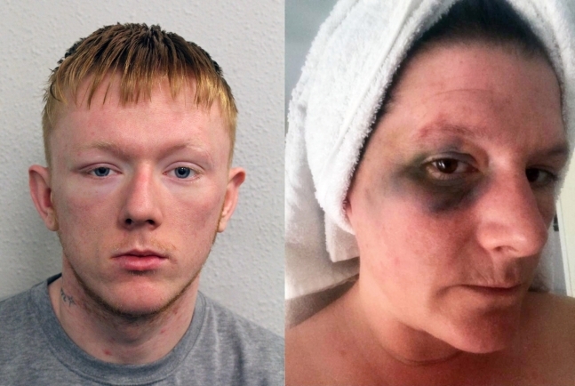 영국에 사는 헬런 스미스(44)는 지난해 외동아들인 션 윌슨(23)에게 8시간 동안 폭행을 당했다. 더 선 캡처