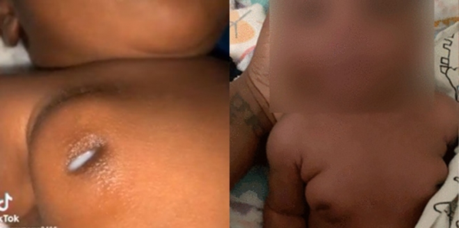 바네사 모란(28)은 지난해 6월 출산한 자신의 아들 카일란 셰릴이 생후 일주일 만에 가슴이 커지기 시작하고 모유까지 나오는 것을 발견했다.nessamoran0406 틱톡