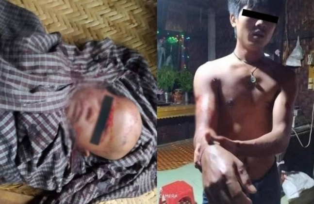12일(현지시간) 오전 미얀마 만달레이에서 미얀마 군부의 소행으로 추정되는 총격이 발생해 한 살배기 여아가 숨지고 그 아버지 니인 찬(29)씨와 다른 행인이 총상을 입었다. R2PMyanmar 트위터
