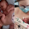 21년 전 샴쌍둥이 분리수술 받은 병원에서 딸 출산한 美여성