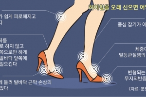 좁은 신발 하이힐에 악! 내발… 쉬는 족족 스트레칭 필요해!