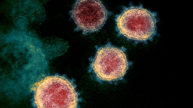 전자현미경으로 본 코로나19 바이러스의 모습., NIAID, CC BY 2.0 , via Wikimedia Commons