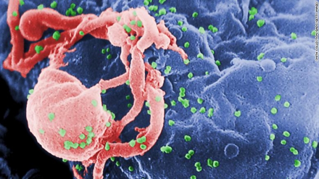 ‘슈퍼 면역력’으로 에이즈 자연 치유…두 번째 완치자 나왔다(사진=세포 위에 보이는 녹색 입자가 에이즈 바이러스/CDC)